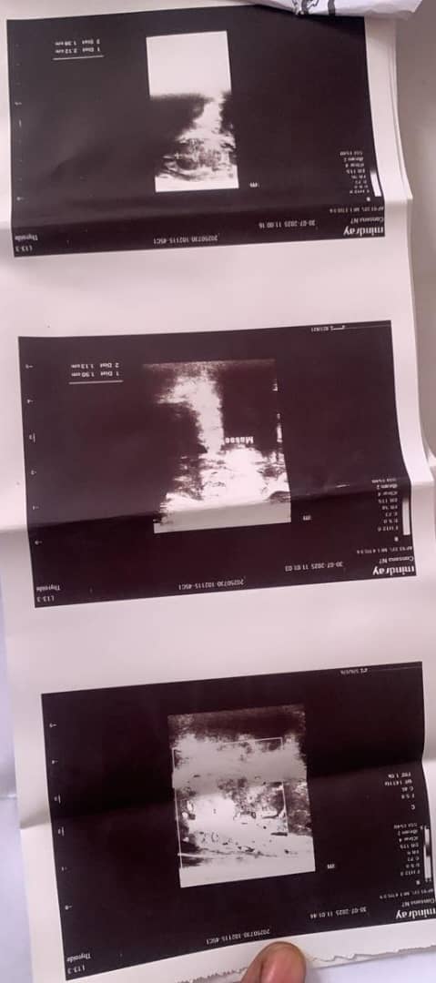 Soutien à notre Maman/Soeur pour ses analyses médicales et traitements - Image 3