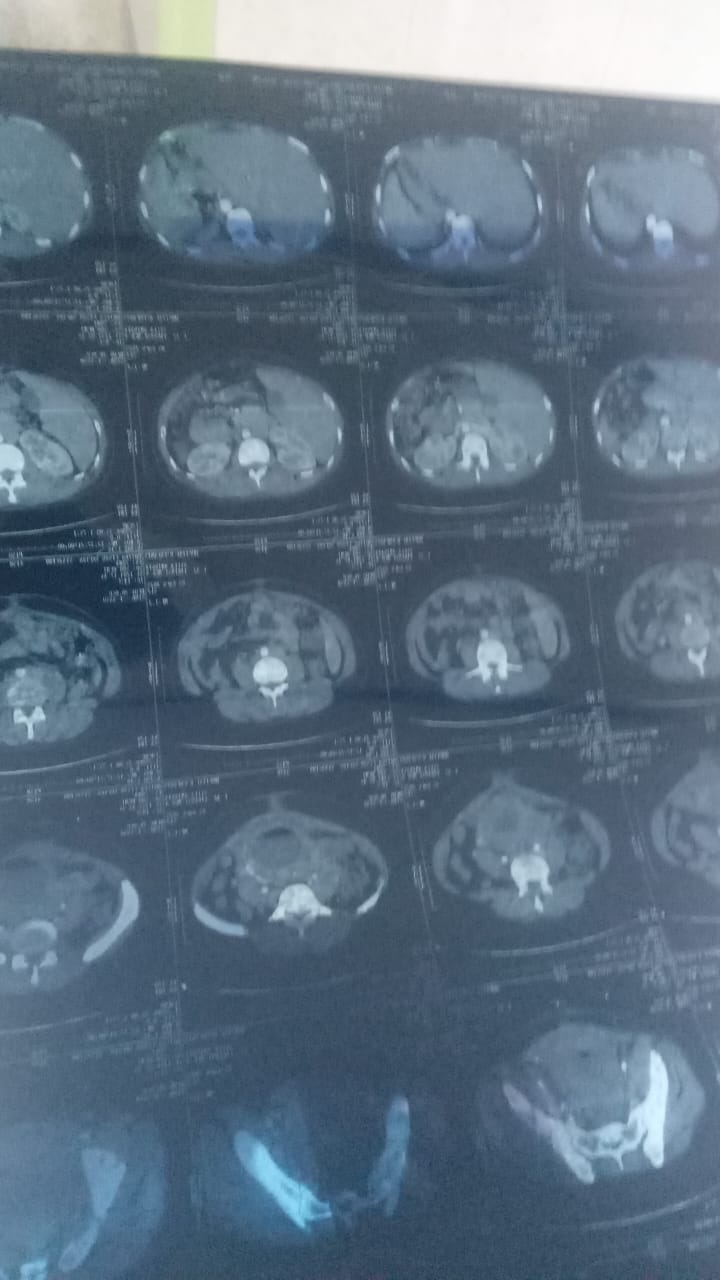 Urgence Medicale Pour Aminata - Image 2