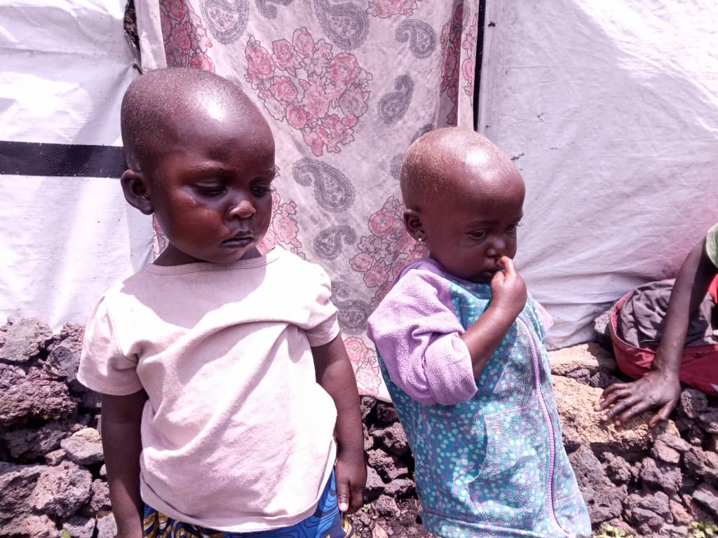 Agissons pour l'avenir : 120 enfants déplacés du Nord-Kivu face à la malnutrition aiguë